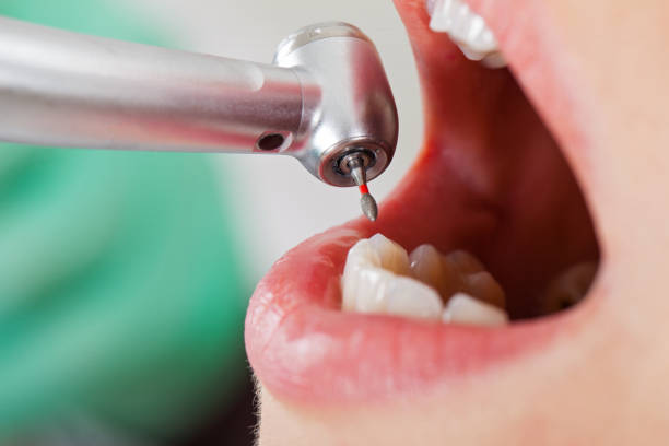 Best Emergency Denture Repair in Petersburg, WV